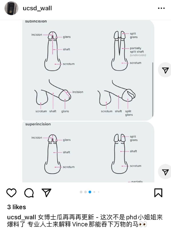 加州大学女博士瓜再后续：情夫Vince为追求更大快感 改造阴茎 直接注射毒品#吃瓜 #加州大学 女博士孕期 #出轨 羊水破裂流产后续：女博士见到网络上都是批评她的言语，继续投稿给学校墙爆料情夫和前夫
