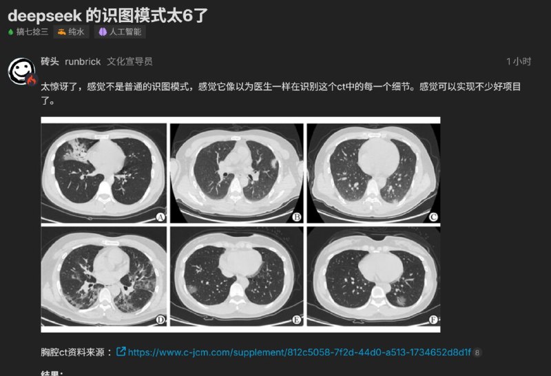 新版DeepSeek识图功能还能读懂CT图DeepSeek V4发布才5天，几乎每天都有新动作，昨天研究人员预告多模态能力即将到来，今天已经有灰度测试