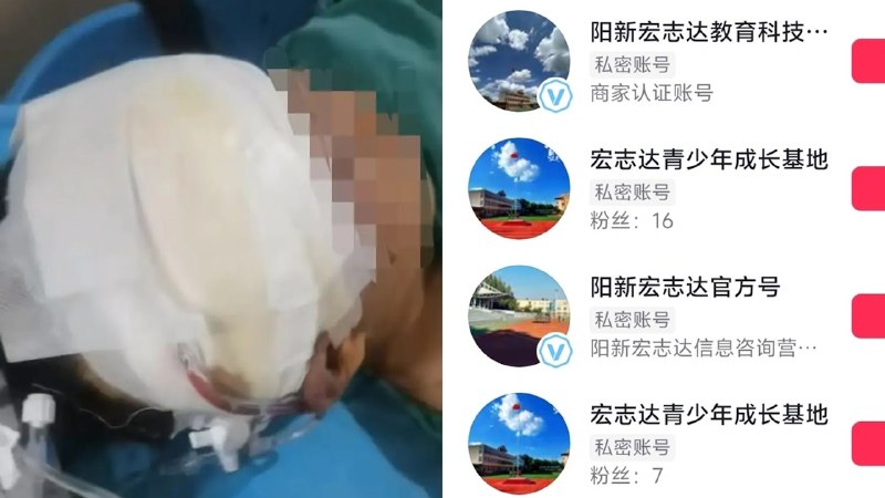 13岁少年因逃学被送湖北｢成长基地｣　遭殴至失明骨折　教官被刑拘一名13岁少年因逃学被父母送入湖北一家“成长基地”