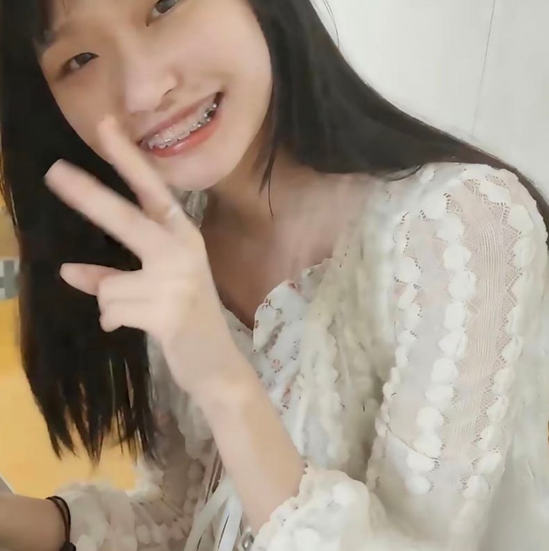 高校里戴牙套的女生，其实藏着不少加分项网上流传一个有趣的恋爱小观察：如果在学校里遇到戴牙套的女生，感觉合适的话，不妨认真对待