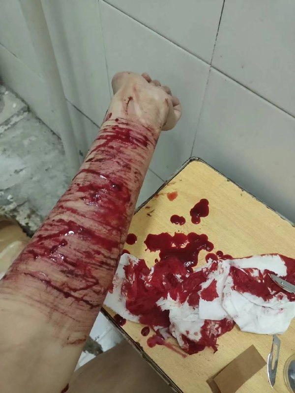 慎点 #自残慎点 #自残