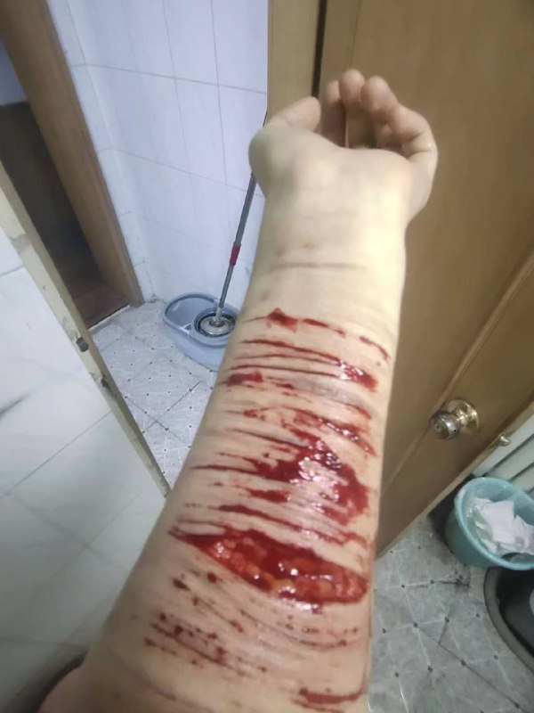 慎点 #自残慎点 #自残