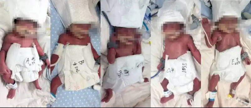 2026 年 2 月 26 日，24 岁的新疆女子迪丽在武汉大学中南医院产下五胞胎（1 男 4 女），母子平安