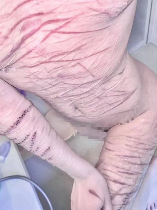 慎点 #自残慎点 #自残