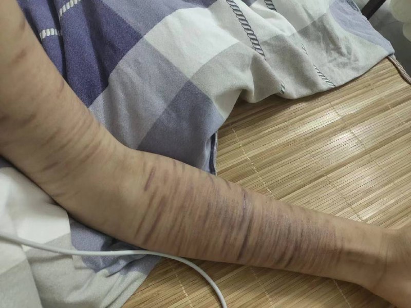 慎点 #自残慎点 #自残