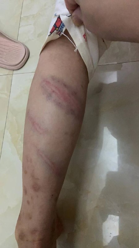 这老师下手够狠的 这得被气多重