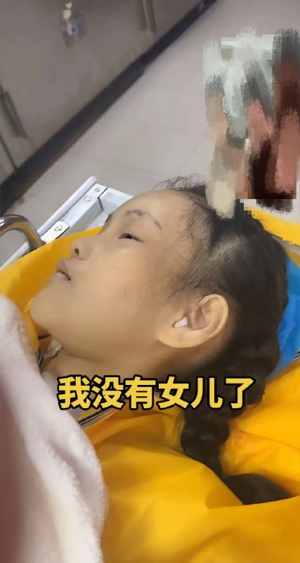 #北京大学国际医院 #刘迎龙一个11岁女孩的生命，不该这样消逝2026年7月20日，我的孩子，11岁，在北京大学国际医院接受了她的第4次心脏手术