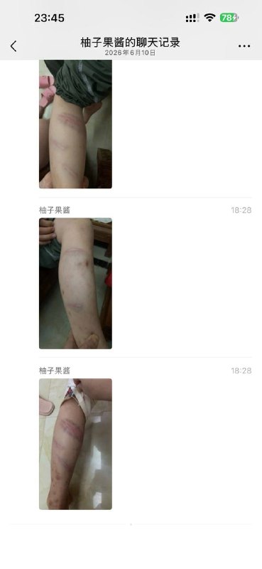 这老师下手够狠的 这得被气多重