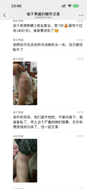 这老师下手够狠的 这得被气多重