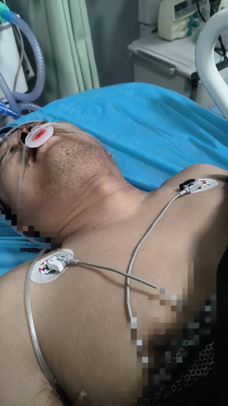 我丈夫在河北省保定市高阳县三利集团有限公司，厂房火灾后的灾后维修作业中，从高处坠落受重伤