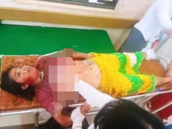 腊戌5号被炮火击中，一死一伤...有消息说是缅军试验库存炮弹有没过期，关键往居民区试验 是个什么逻辑？感谢家人们投稿！腊戌5号被炮火击中，一死一伤...有消息说是缅军试验库存炮弹有没过期，关键往居民区试验 是个什么逻辑？感谢家人们投稿！