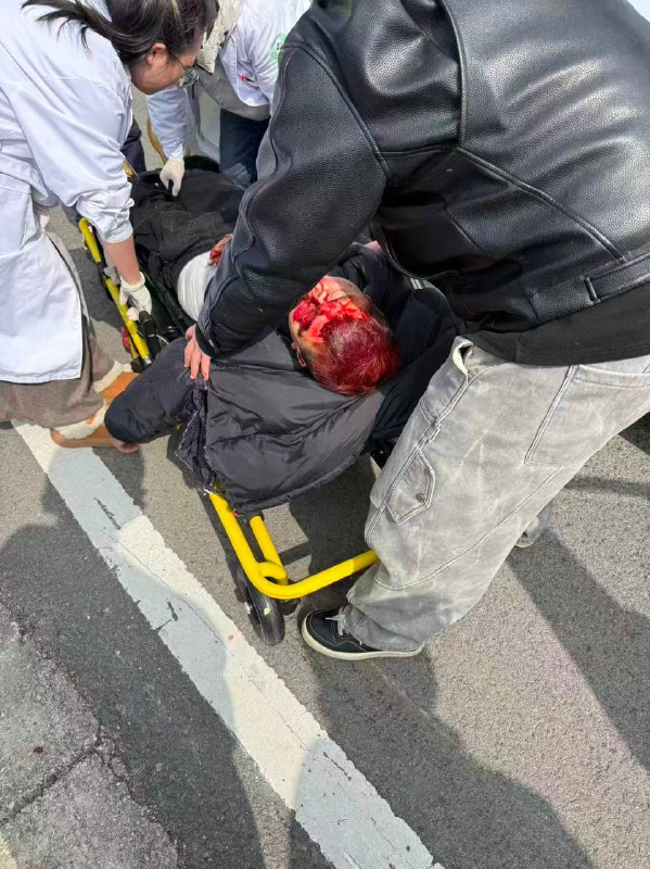 这还能活嘛 #车祸感谢家人们投稿！这还能活嘛 #车祸感谢家人们投稿！