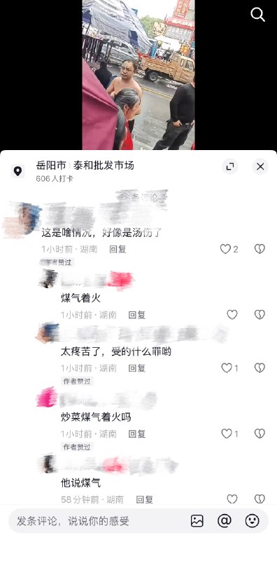 4月11日，湖南岳阳一男子煤气起火被烫伤，皮都掉了看着都疼感谢 Group  投稿！4月11日，湖南岳阳一男子煤气起火被烫伤，皮都掉了看着都疼感谢 Group  投稿！