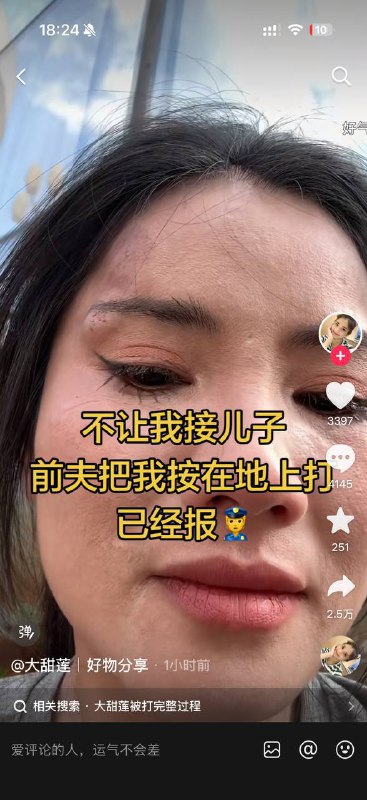 海南大甜莲接孩子被前夫暴打感谢家人们投稿！海南大甜莲接孩子被前夫暴打感谢家人们投稿！
