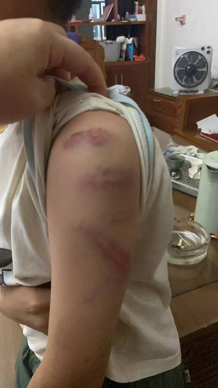 这老师下手够狠的 这得被气多重