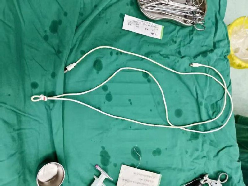 8OcmUSB线插入尿道！男子无法排尿“医生救我下腹快炸了