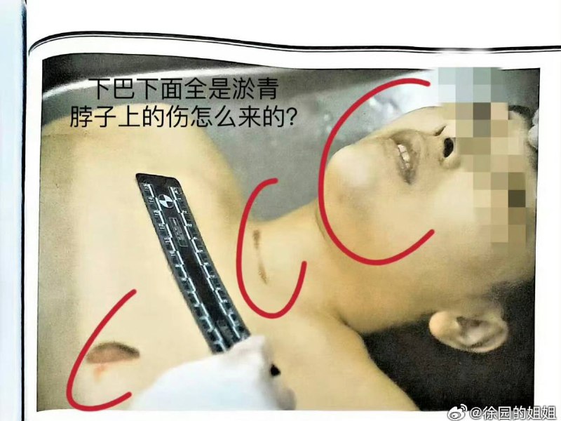 【除夕夜的泣血发声：大连普兰店女孩徐园离世四周年】“公道未到，我便不休