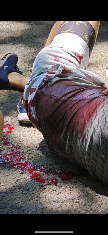 6月10日，网传吉林市北山公园，有四名外国人遭遇袭击被捅