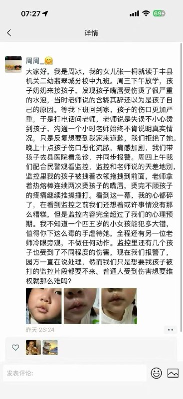 幼儿园教师用热熔枪烫伤小女孩江苏徐州丰县教育局5月29日发布情况通报：近日，接到一幼儿园教师不当对待学生的反映后，我局高度重视，迅速成立调查组，会同相关部门开展调查处置