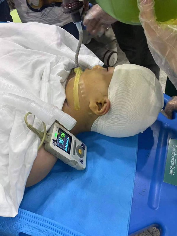 湖南 #长沙 一小学男教师打伤学生头骨致其开颅手术 #打学生#老师 #打人 #小学生湖南 #长沙 一小学男教师打伤学生头骨致其开颅手术 #打学生#老师 #打人 #小学生