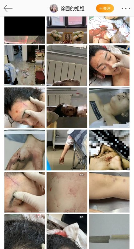 今天辽宁大连普兰店，女孩徐园和男友吵架后惨死男友家中，心脏中刀，男友却被判无罪，已经过去900多天了凶手至今还逍遥法外，嫌疑人还非常嚣张的跟踪、辱骂和威胁受害人家属