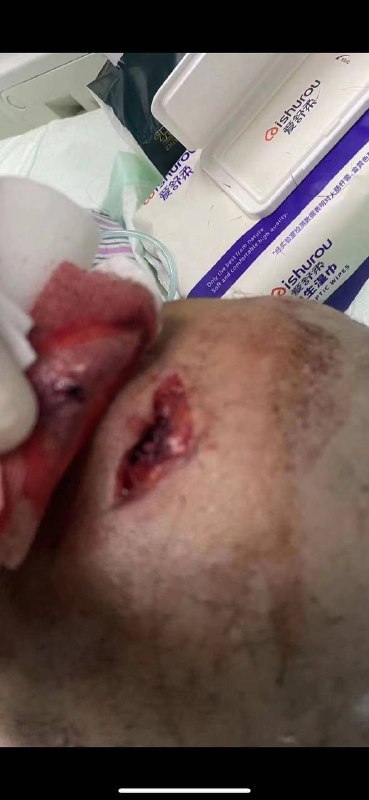 亲爱的家人们：     早上好！由于我孩子刘语辰在教室内被宋雨明老师残忍伤害一事在群内打扰大家了