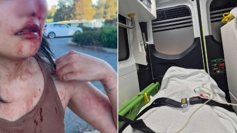 中国女子在澳大利亚遭种族主义袭击并被持刀威胁一名中国女子在澳大利亚首都堪培拉遭遇种族辱骂并被袭击，受伤流血后被送医治疗