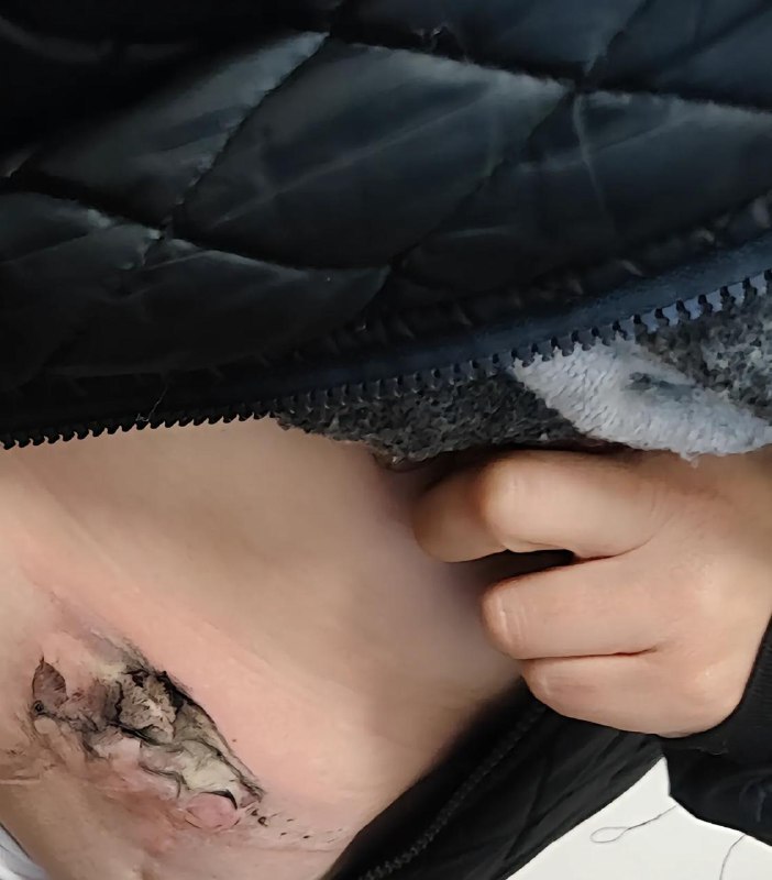 红米 手机爆炸10 月 22 日，河南一女子在街头时，口袋中的红米 Note 13 Pro 手机突然爆炸