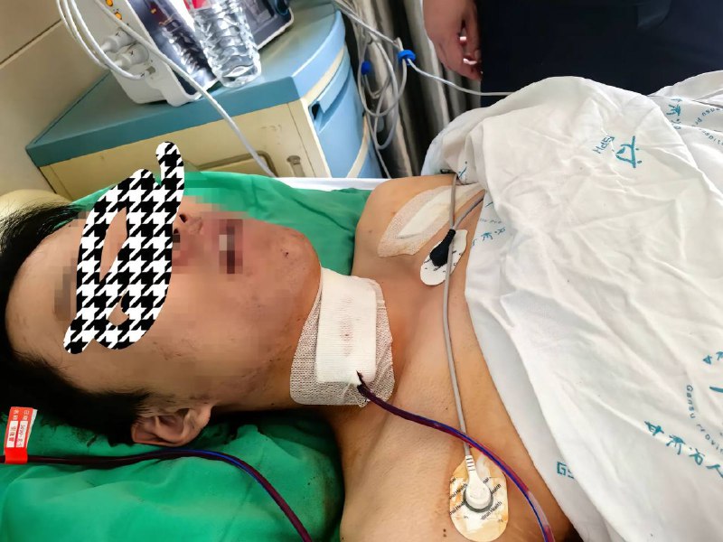 8月5日凌晨4时左右,孩子睡梦中在兰州大奔机电设备有限公司员工宿舍内被伪装打扮的同事 #割喉 出事后,公司不闻不问,医药费家属自付,嫌犯潜逃后被抓获,公安机关人故意伤害罪对其进行十日治安拘留by 匿名投稿8月5日凌晨4时左右,孩子睡梦中在兰州大奔机电设备有限公司员工宿舍内被伪装打扮的同事 #割喉 出事后,公司不闻不问,医药费家属自付,嫌犯潜逃后被抓获,公安机关人故意伤害罪对其进行十日治安拘留by 匿名投稿