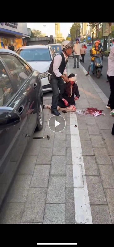 婁律師今日下午在桐鄉市人民法院參加一民事案件庭審代理活動結束後，遭該案對方當事人曹某某（男，36歲， #河南 籍）尾隨攜榔頭襲擊，造成婁律師頭部多處骨折，目前在桐鄉市第一人民醫院ICU救治，病情尚穩定