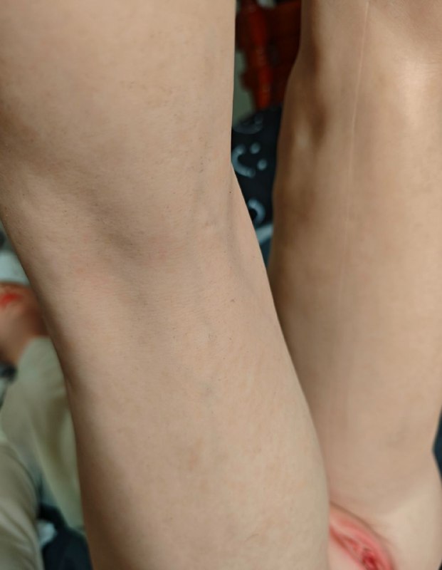 #实体娃娃＃暴雨科技＃1号冰实拍＃美脚＃玉手#实体娃娃＃暴雨科技＃1号冰实拍＃美脚＃玉手