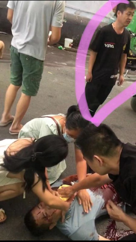 广西 #南宁 吵架发生捅人事件广西 #南宁 吵架发生捅人事件