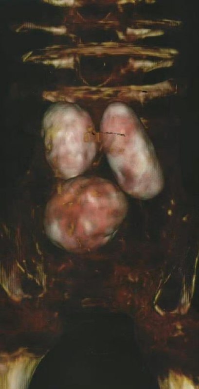 墨西哥 刚刚公开在听证会上展示了 #外星人 #尸体：  • 在秘鲁的硅藻矿中被找到  • 于2017年在帕尔帕和纳斯卡之间发现  • 不属于地球的进化过程  • 碳测年约1000年前  • 不是木乃伊，尸体完整无缺墨西哥 刚刚公开在听证会上展示了 #外星人 #尸体：  • 在秘鲁的硅藻矿中被找到  • 于2017年在帕尔帕和纳斯卡之间发现  • 不属于地球的进化过程  • 碳测年约1000年前  • 不是木乃伊，尸体完整无缺