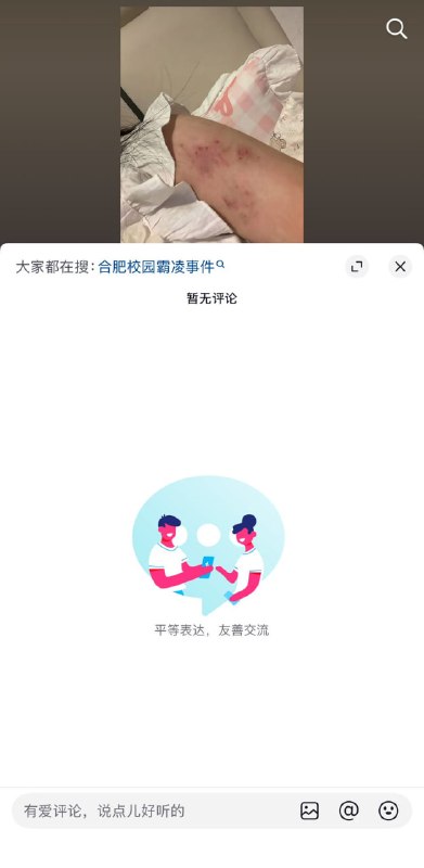 5月10日，一名来自安徽合肥的女孩，讲述自己上初中后遭到校园霸凌的经历，并晒出了被同学们打到淤青的身体，随后抖音出手，清空了所有评论，并删除了女孩发布的贴文
