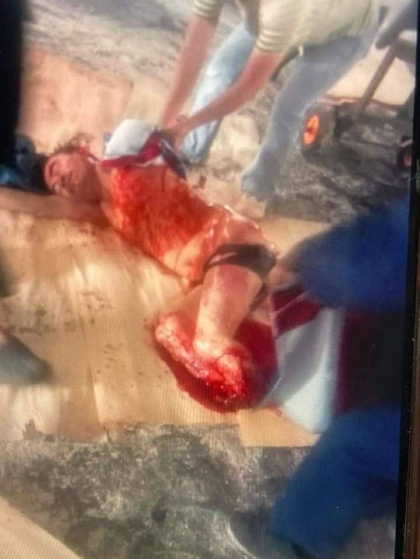 #工厂 #事故 ⛑️ 操作失误 陷入 #绞肉机 🥹 Crazy ！#工厂 #事故 ⛑️ 操作失误 陷入 #绞肉机 🥹 Crazy ！