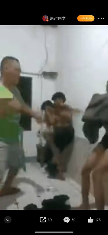 #猪仔之缅甸🇲🇲江湖山东济南男子讨要17万债款不成，反被朋友2.5万卖到缅甸，进入诈骗集团被抢指头，7楼跳窗导致爆裂性骨折，医院再次逃亡你敢跑老子用枪打死你，我不会打你头，但我会打你手和脚”，这是李伟（大头）在缅甸医院受到的威胁