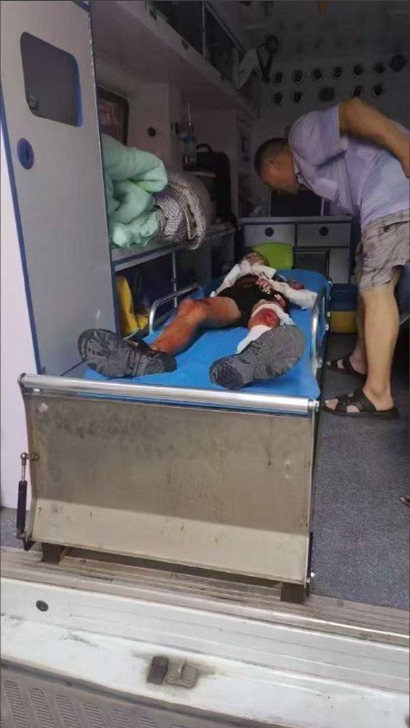 湖南 耒阳 发生一起故意伤害案，致2死3伤，嫌犯被抓获 #警方通报 #刀仔 #捅人 #报复社会 #补充 👉 查看详情 👈感谢来自某频道的投稿！湖南 耒阳 发生一起故意伤害案，致2死3伤，嫌犯被抓获 #警方通报 #刀仔 #捅人 #报复社会 #补充 👉 查看详情 👈感谢来自某频道的投稿！