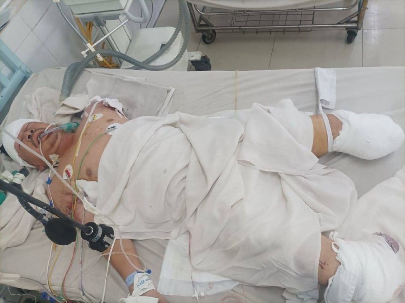 #工厂 #事故 ⛑️ 操作失误 陷入 #绞肉机 🥹 Crazy ！#工厂 #事故 ⛑️ 操作失误 陷入 #绞肉机 🥹 Crazy ！