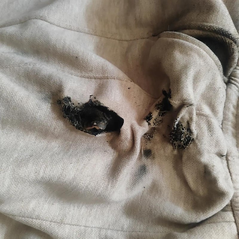 红米 手机爆炸10 月 22 日，河南一女子在街头时，口袋中的红米 Note 13 Pro 手机突然爆炸