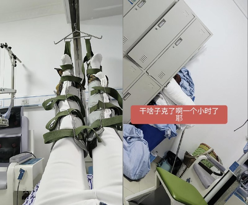 患者做牵引双腿被吊一个多小时无人管，医院回应：计时器没响，“忘了”近日，贵州仁怀一名女子自称，在医院接受牵引治疗时，因医生未及时解除设备，自己双腿被悬吊一个多小时，期间多次呼喊无人应答，最终只能请朋友赶来叫医护人员