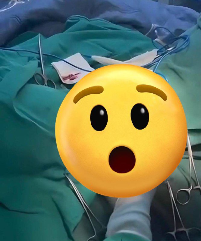 ⚠️ 离大谱了！2月2日，陕西中医药大学附属医院妇二科搞“内部培训”，结果竟然直接在（微信视频号）上直播妇科手术！隐私全光！ 视频里清晰展示了女性患者的私密部位，长达4分钟！🫣 🫣🈲🈲来咱们吃瓜18禁电报群看哦👉👉 