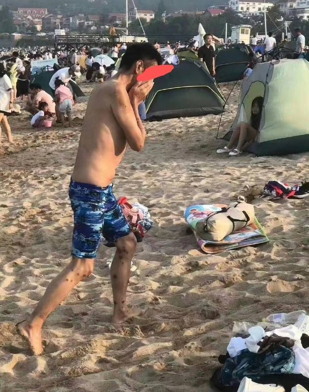 关于 #猴痘 需要了解的实用知识 #给子关于 #猴痘 需要了解的实用知识 #给子