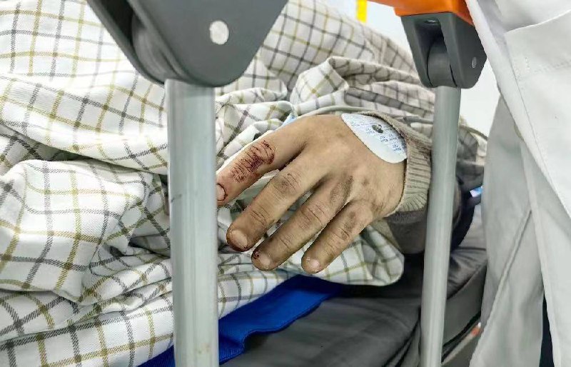 杭州东站 跳轨 #后续：3月30日上午，一名旅客在杭州火车东站跳入轨道后与列车发生剐蹭受伤昏迷，被紧急送往医院救治