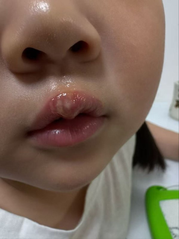 幼儿园教师用热熔枪烫伤小女孩江苏徐州丰县教育局5月29日发布情况通报：近日，接到一幼儿园教师不当对待学生的反映后，我局高度重视，迅速成立调查组，会同相关部门开展调查处置
