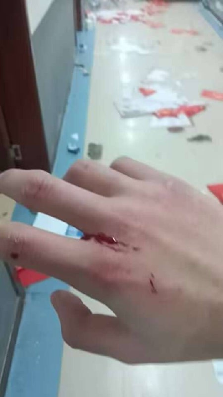 山东 环帝 网瘾 戒除 #学校 #学生 有组织的发起 暴动山东 环帝 网瘾 戒除 #学校 #学生 有组织的发起 暴动