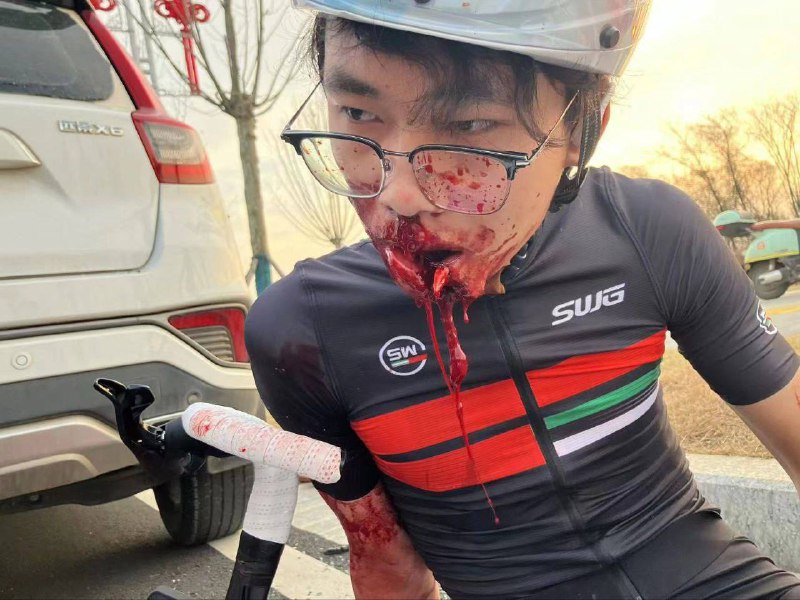 #骑行 🚴‍♀️ #血腥 #车祸 嘴巴 #烂了 明天不骑了 🤯#骑行 🚴‍♀️ #血腥 #车祸 嘴巴 #烂了 明天不骑了 🤯