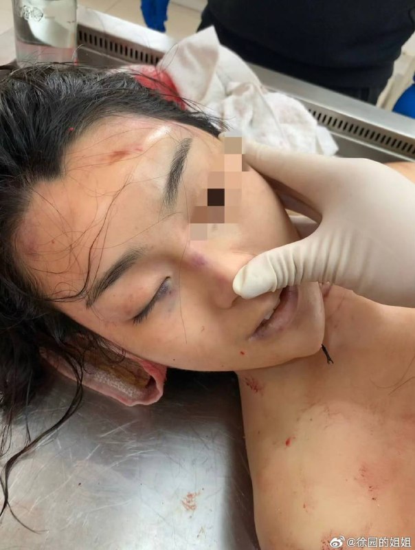【除夕夜的泣血发声：大连普兰店女孩徐园离世四周年】“公道未到，我便不休