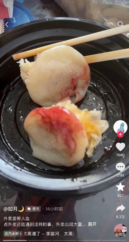 “吃到人血烧麦，吃阻断药后维权，视频惨遭下架” #食品安全6月13日，一网友爆料，她在 #杭州 苏杭婆婆商家点外卖，结果吃到了大量 #血迹 的 #烧麦