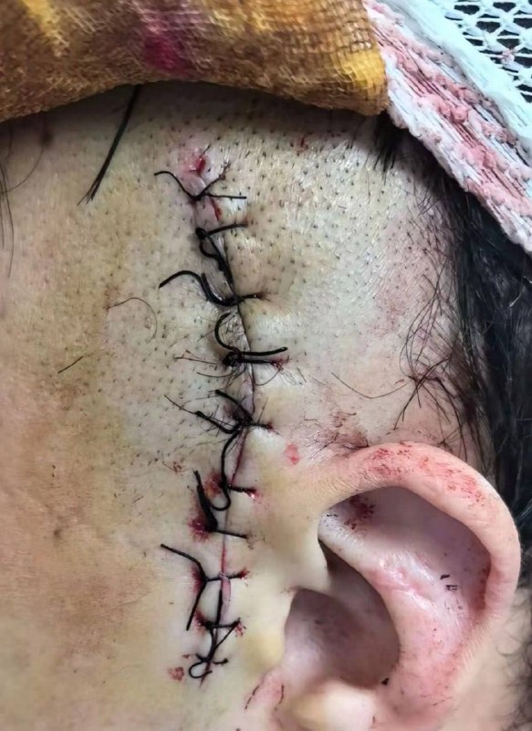 补充7.31广州，男模在KTV陪酒喝了一箱酒都喝吐了，客户结账时不但不给小费还要他出酒钱，跟客户理论时被对方打伤住进ICU..这几天住院icu急救的钱都是自己再花，对方还在外面自由活动呢