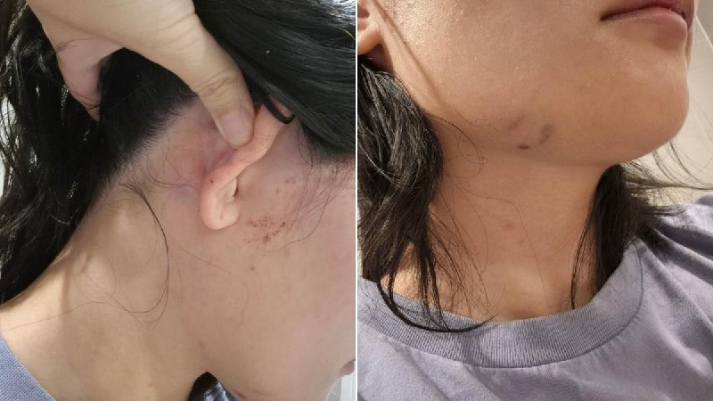 中国女子在澳大利亚遭种族主义袭击并被持刀威胁一名中国女子在澳大利亚首都堪培拉遭遇种族辱骂并被袭击，受伤流血后被送医治疗